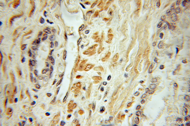 MECP2 Antibody in Immunohistochemistry (Paraffin) (IHC (P))