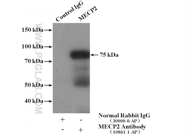 MECP2 Antibody in Immunoprecipitation (IP)