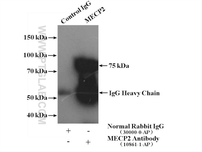 MECP2 Antibody in Immunoprecipitation (IP)