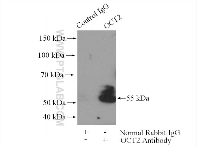 OCT2 Antibody in Immunoprecipitation (IP)