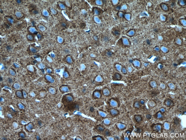 ATP1A3 (C-terminal) Antibody in Immunohistochemistry (Paraffin) (IHC (P))