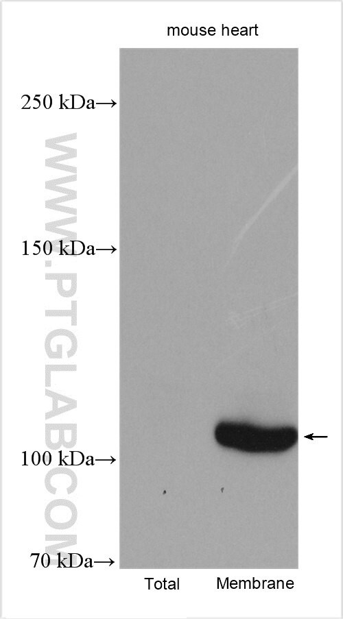 ATP1A3 (C-terminal) Antibody in Western Blot (WB)