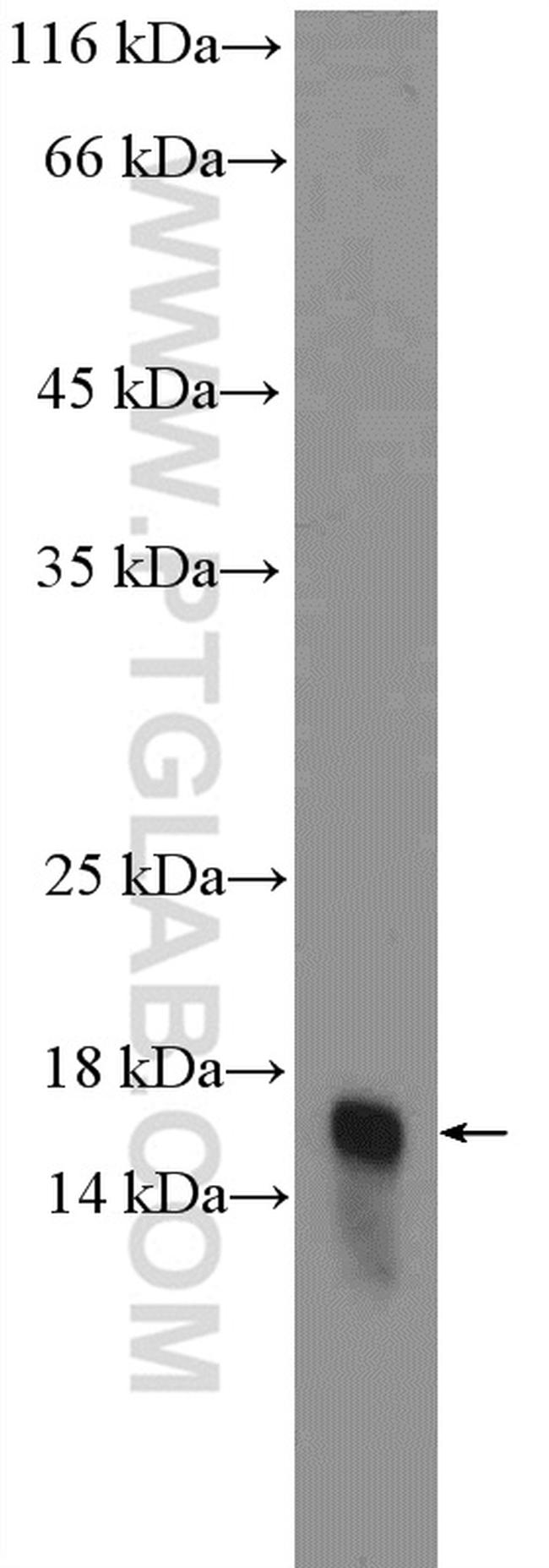 ARMET Antibody in Western Blot (WB)