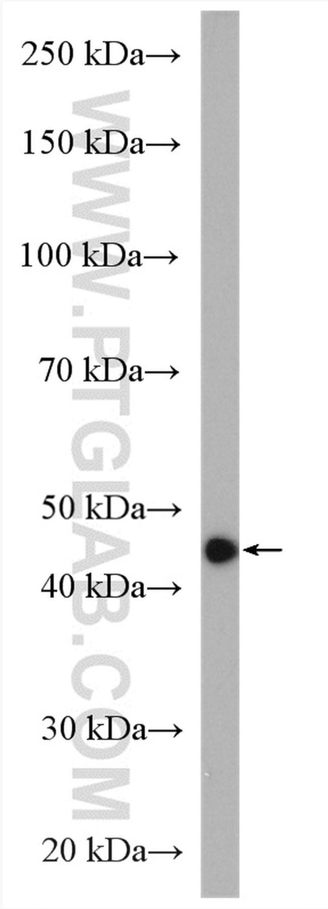 HSP47 Antibody in Western Blot (WB)