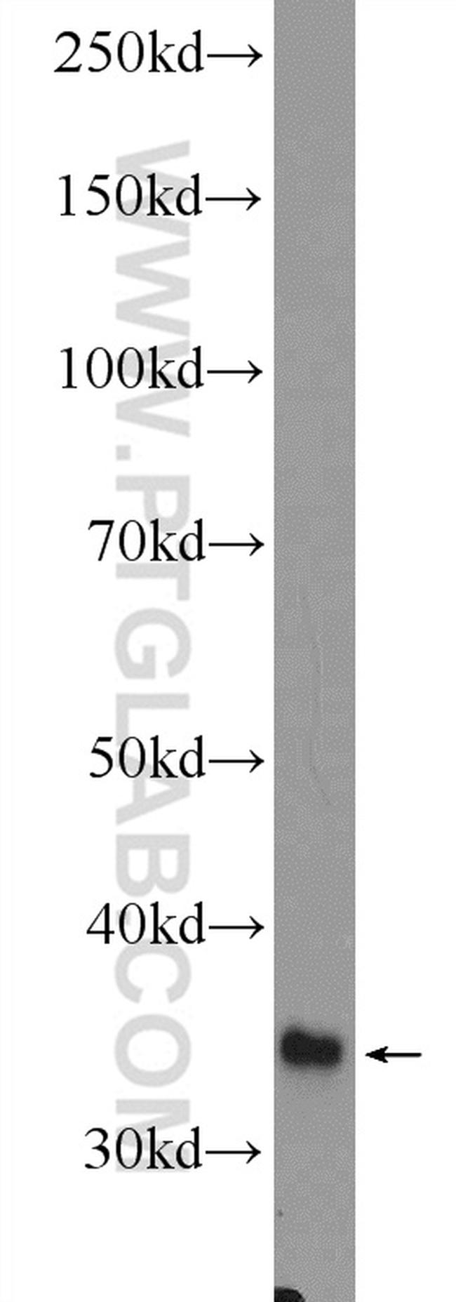 GLYAT Antibody in Western Blot (WB)