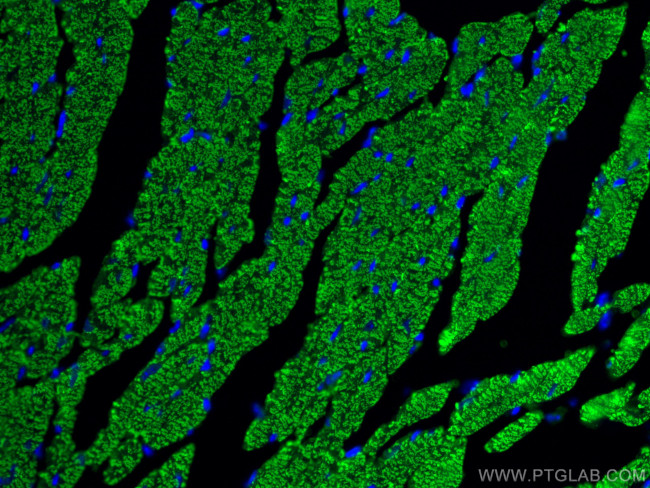 Myosin Light Chain 2 Antibody in Immunohistochemistry (PFA fixed) (IHC (PFA))