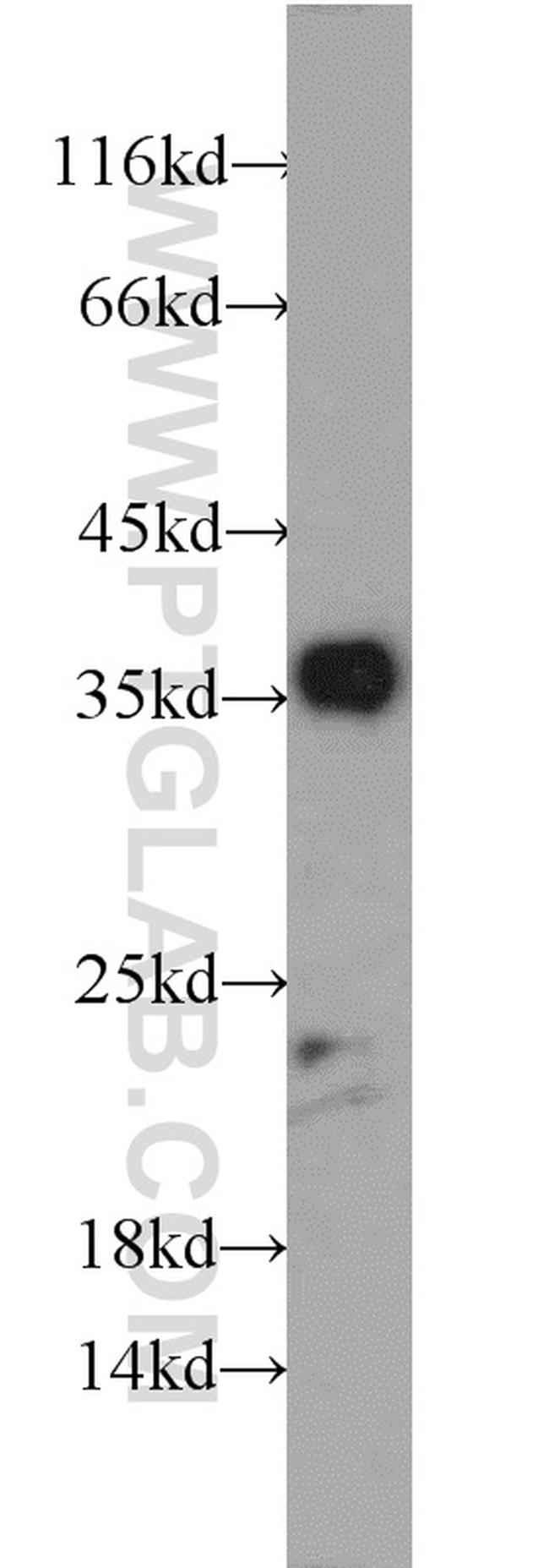 DUSP13 Antibody in Western Blot (WB)