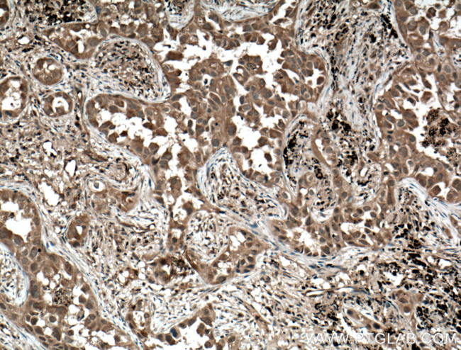 MYL3 Antibody in Immunohistochemistry (Paraffin) (IHC (P))