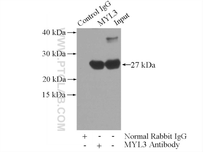 MYL3 Antibody in Immunoprecipitation (IP)