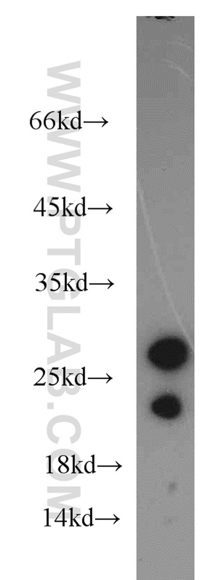 MYL3 Antibody in Western Blot (WB)