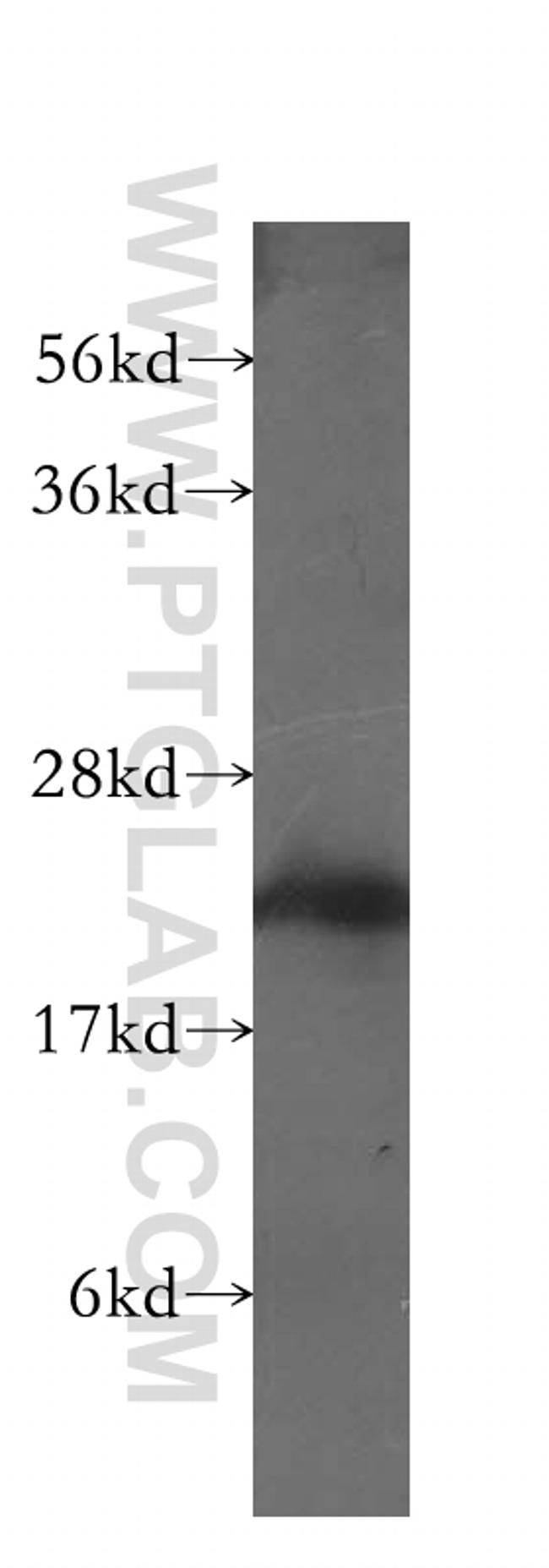 MYL3 Antibody in Western Blot (WB)