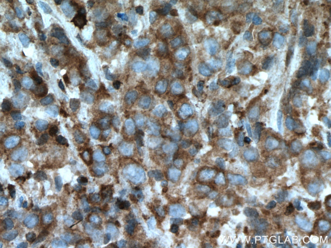 ARP2 Antibody in Immunohistochemistry (Paraffin) (IHC (P))