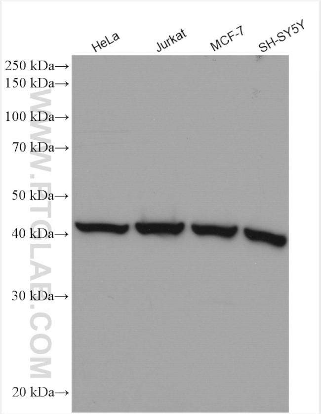 ARP2 Antibody in Western Blot (WB)