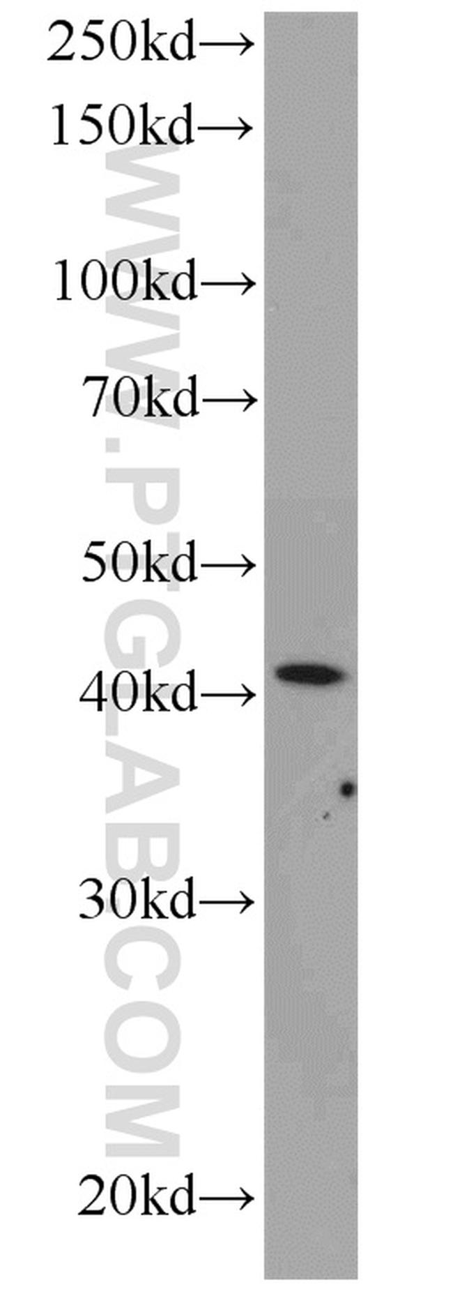 ARP2 Antibody in Western Blot (WB)