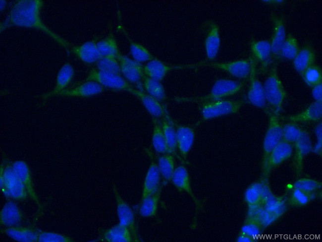 ARP2 Antibody in Immunocytochemistry (ICC/IF)