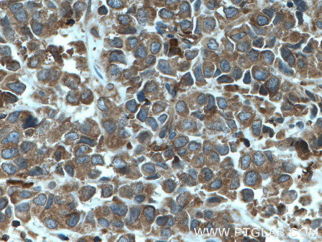 ARP2 Antibody in Immunohistochemistry (Paraffin) (IHC (P))