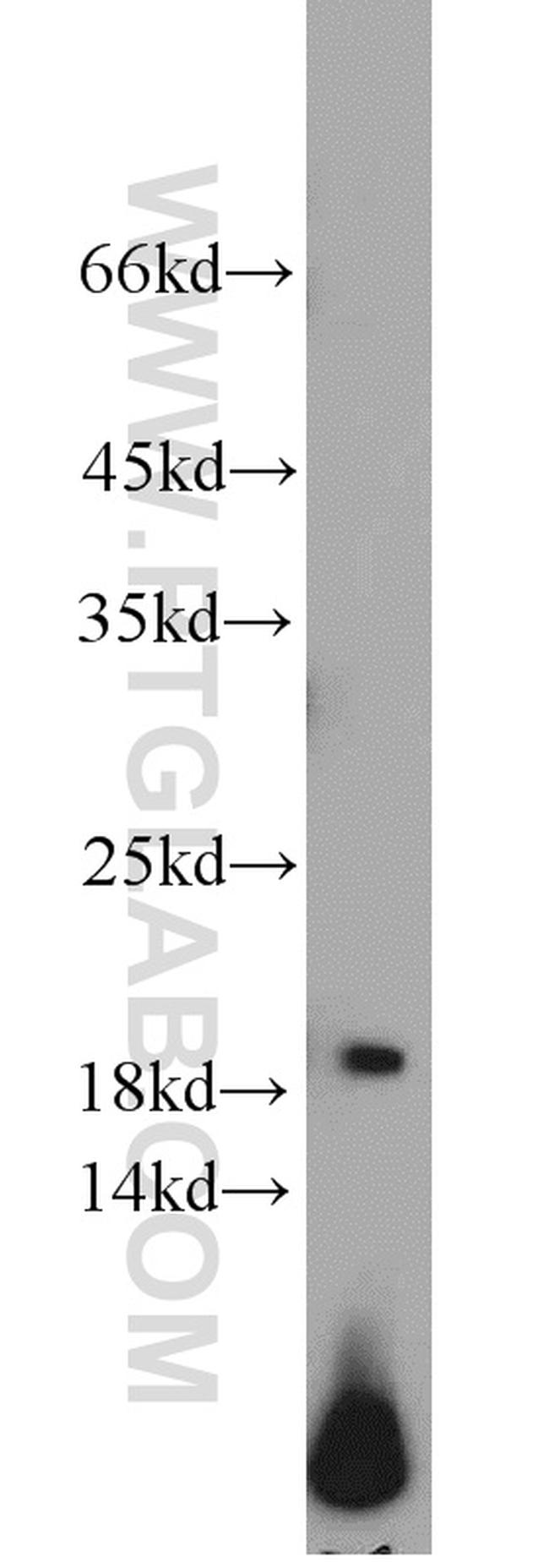 ARPC4 Antibody in Western Blot (WB)