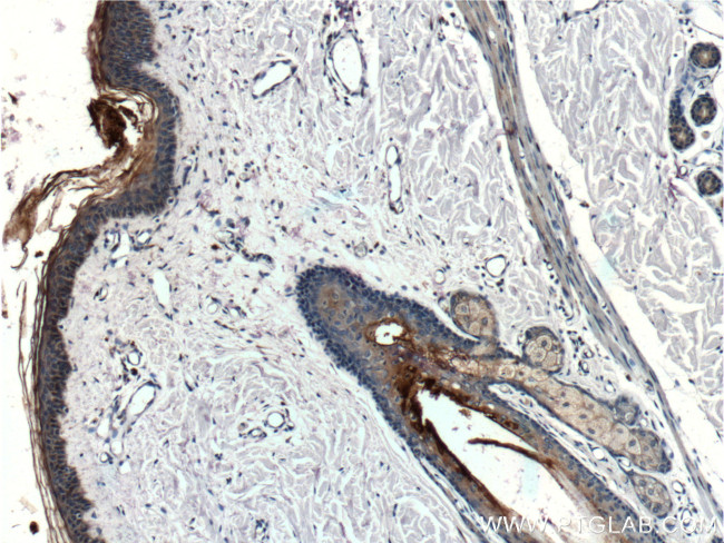 Cathepsin L Antibody in Immunohistochemistry (Paraffin) (IHC (P))