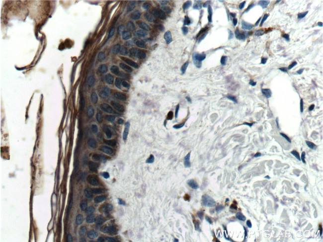 Cathepsin L Antibody in Immunohistochemistry (Paraffin) (IHC (P))