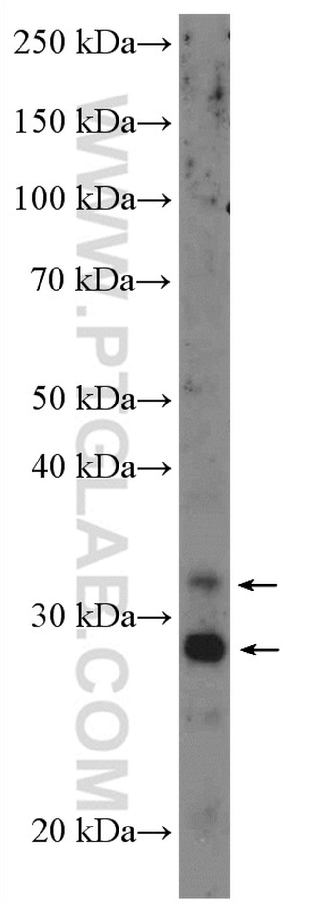 Cathepsin L Antibody in Western Blot (WB)