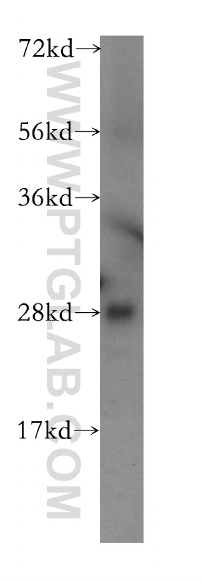 TPK1 Antibody in Western Blot (WB)