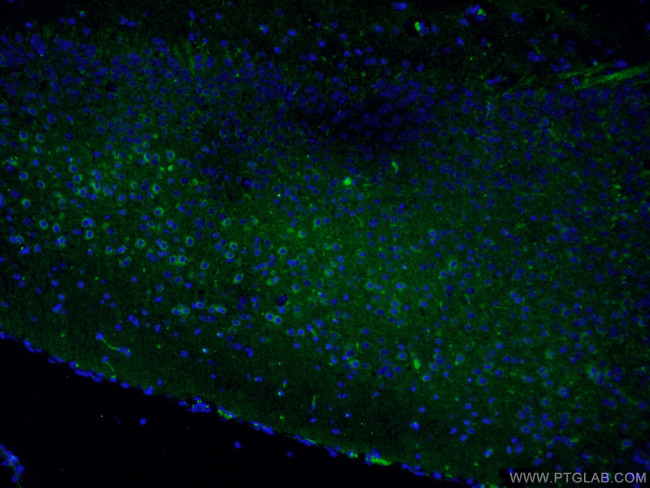 CRH/CRF Antibody in Immunohistochemistry (Paraffin) (IHC (P))