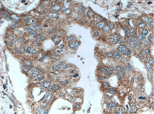 CRH/CRF Antibody in Immunohistochemistry (Paraffin) (IHC (P))