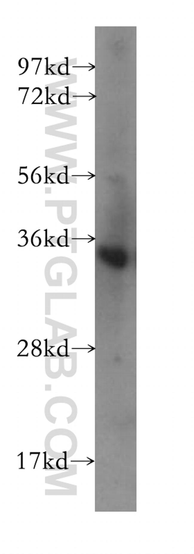 CRH/CRF Antibody in Western Blot (WB)