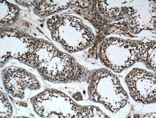 ARL3 Antibody in Immunohistochemistry (Paraffin) (IHC (P))