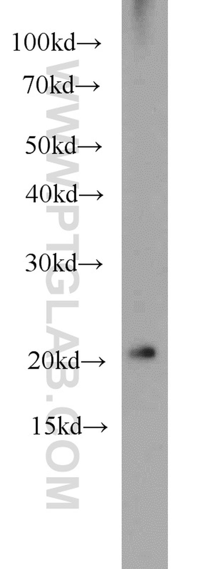 ARL3 Antibody in Western Blot (WB)