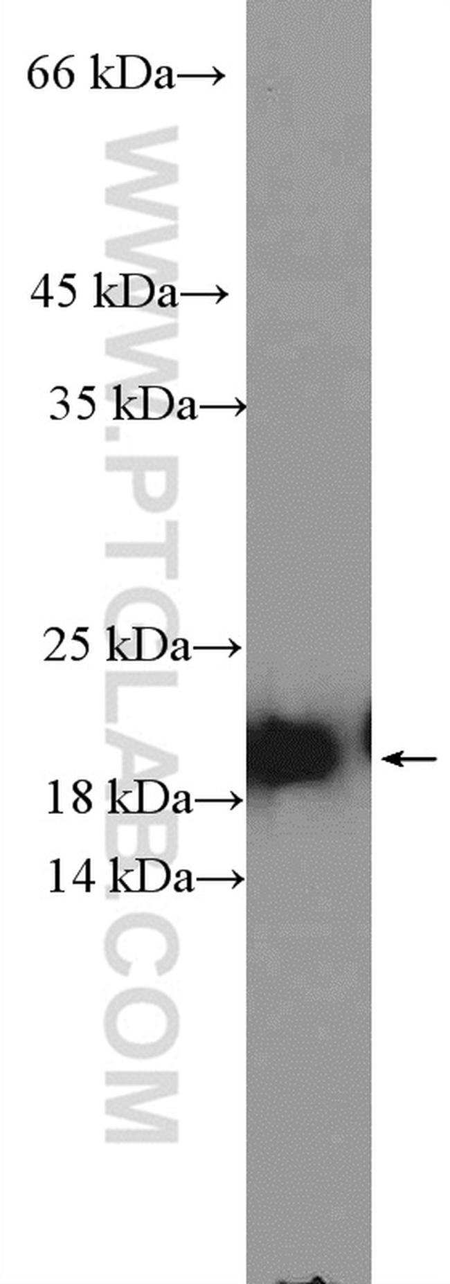 ARL3 Antibody in Western Blot (WB)