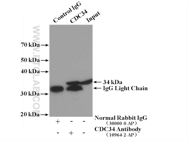 CDC34 Antibody in Immunoprecipitation (IP)