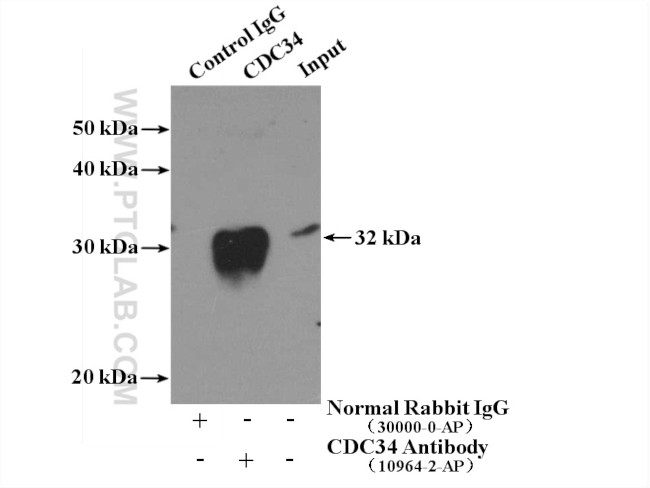 CDC34 Antibody in Immunoprecipitation (IP)