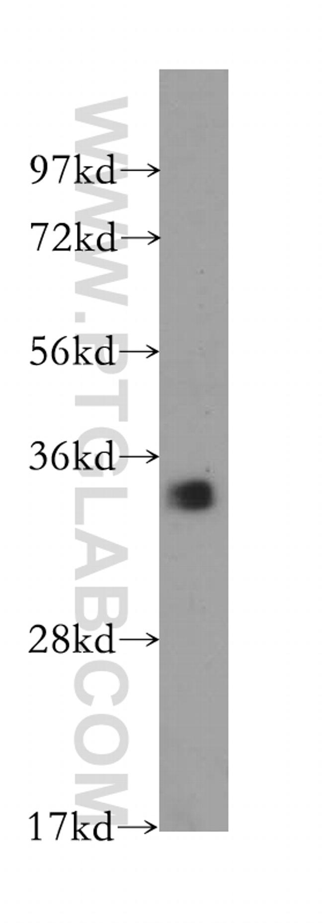 CDC34 Antibody in Western Blot (WB)