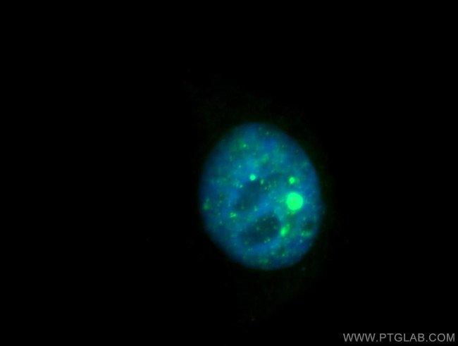 Coilin Antibody in Immunocytochemistry (ICC/IF)