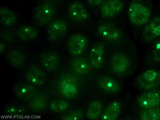 Coilin Antibody in Immunocytochemistry (ICC/IF)