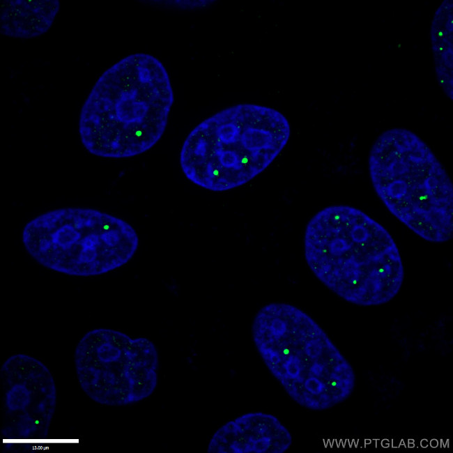 Coilin Antibody in Immunocytochemistry (ICC/IF)