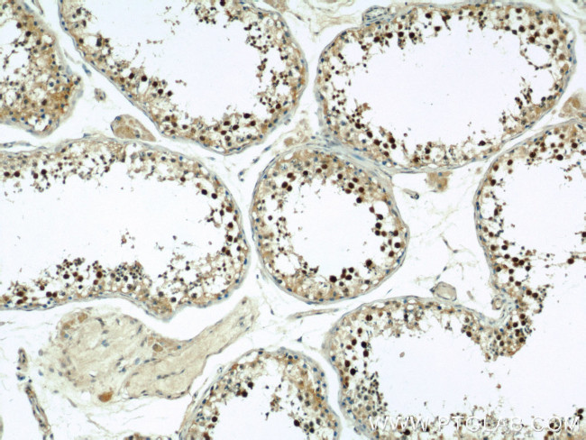 Coilin Antibody in Immunohistochemistry (Paraffin) (IHC (P))