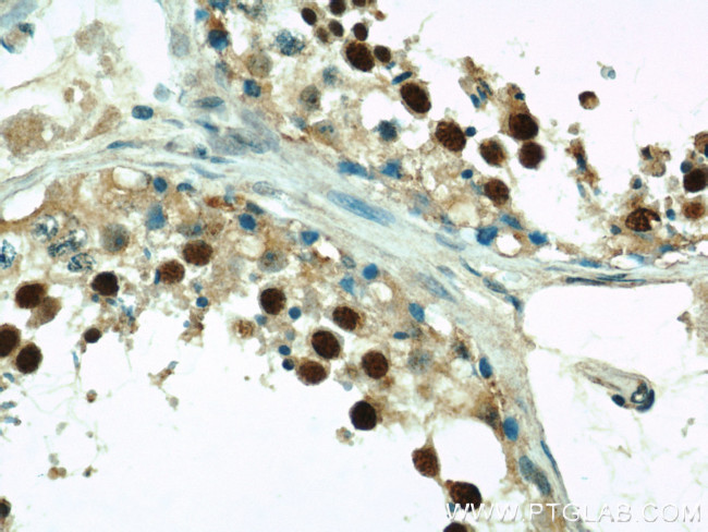 Coilin Antibody in Immunohistochemistry (Paraffin) (IHC (P))