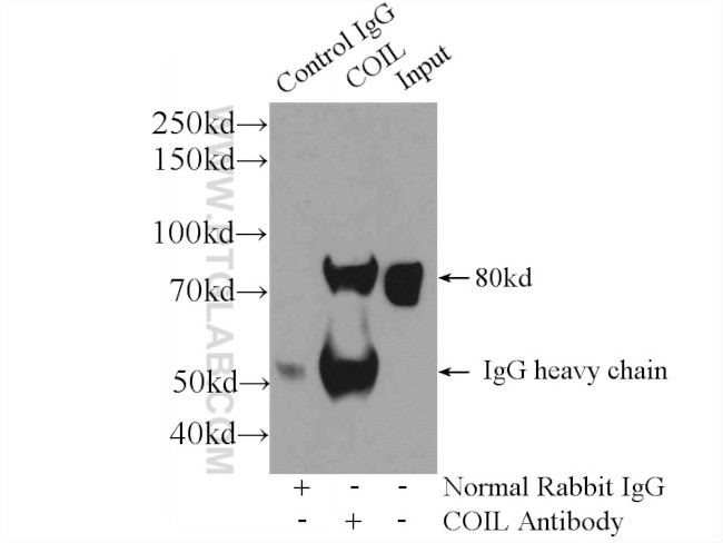 Coilin Antibody in Immunoprecipitation (IP)