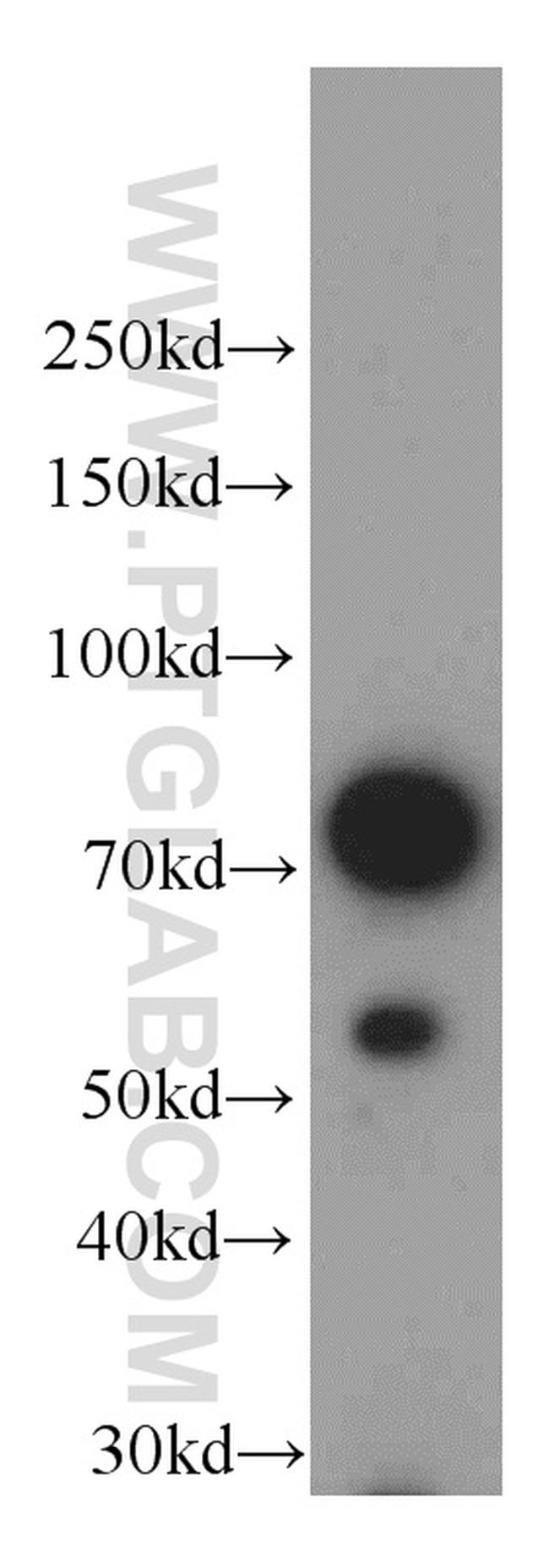 Coilin Antibody in Western Blot (WB)