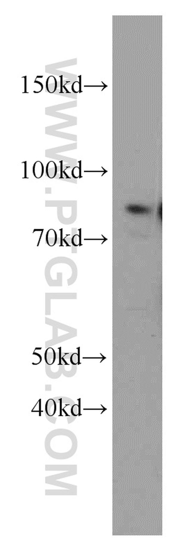 Coilin Antibody in Western Blot (WB)