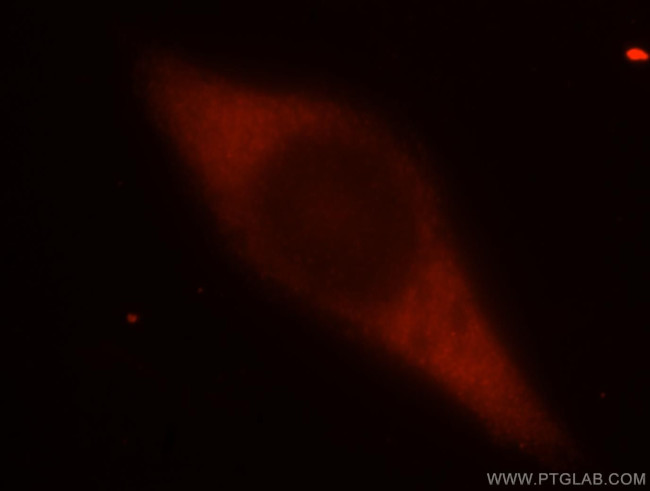 PABPC1/PABP Antibody in Immunocytochemistry (ICC/IF)