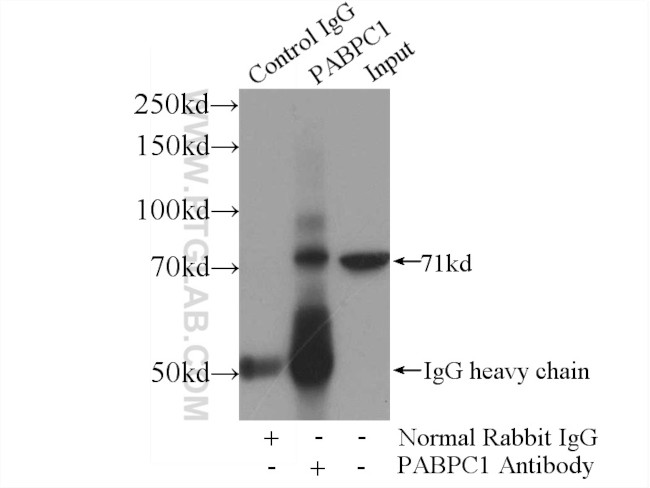 PABPC1/PABP Antibody in Immunoprecipitation (IP)