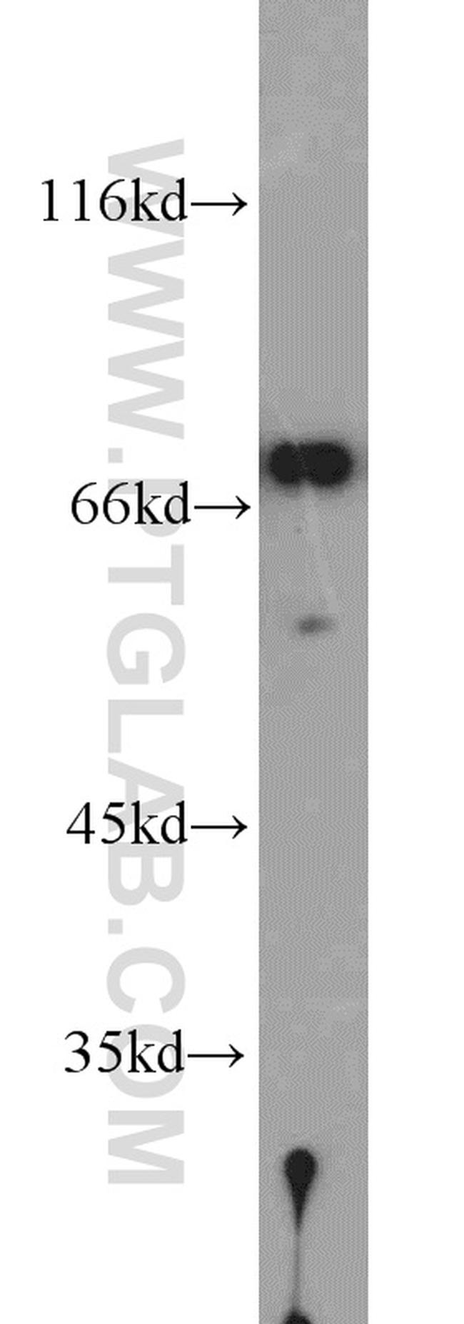 PABPC1/PABP Antibody in Western Blot (WB)