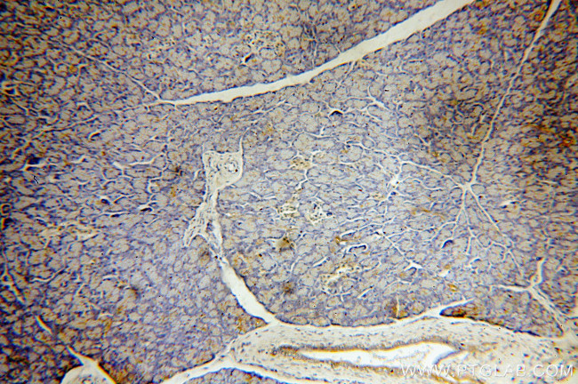 PABPC1/PABP Antibody in Immunohistochemistry (Paraffin) (IHC (P))