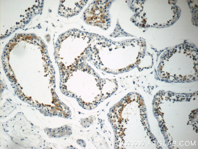 PABPC1/PABP Antibody in Immunohistochemistry (Paraffin) (IHC (P))