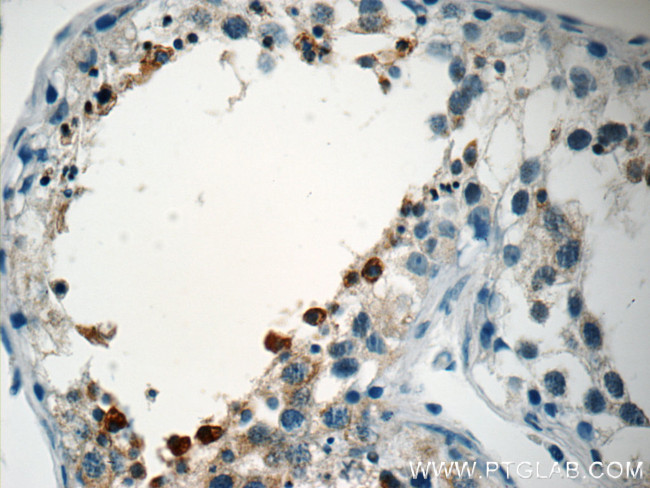 PABPC1/PABP Antibody in Immunohistochemistry (Paraffin) (IHC (P))