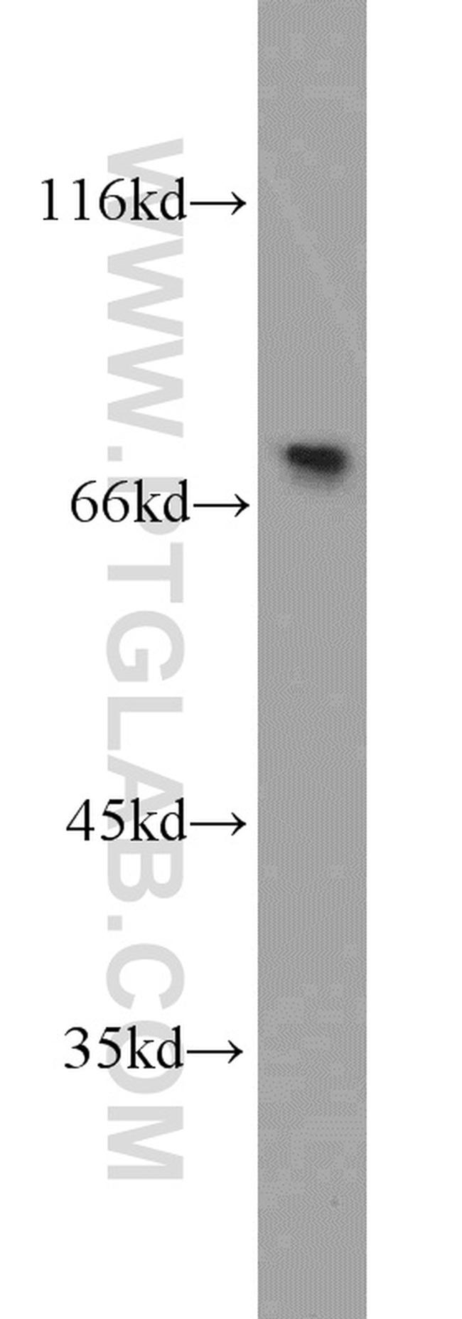 PABPC1/PABP Antibody in Western Blot (WB)