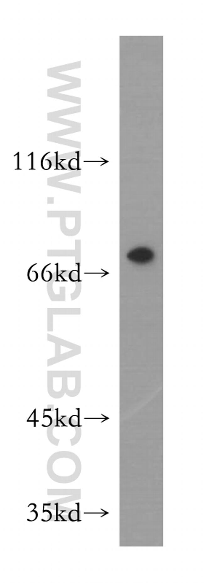 PABPC1/PABP Antibody in Western Blot (WB)